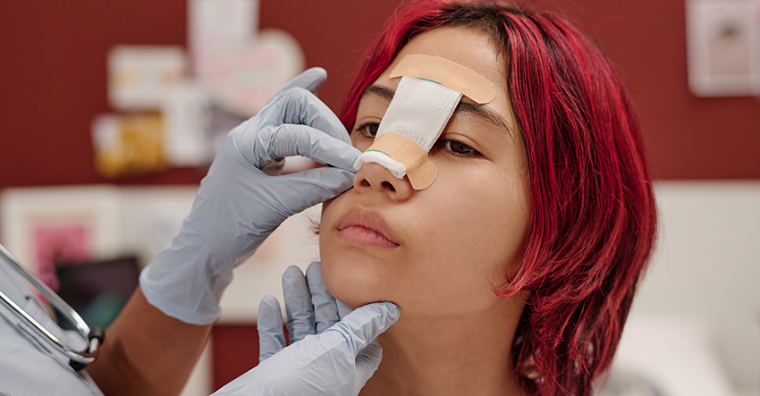 la rinoplastia como tecnica