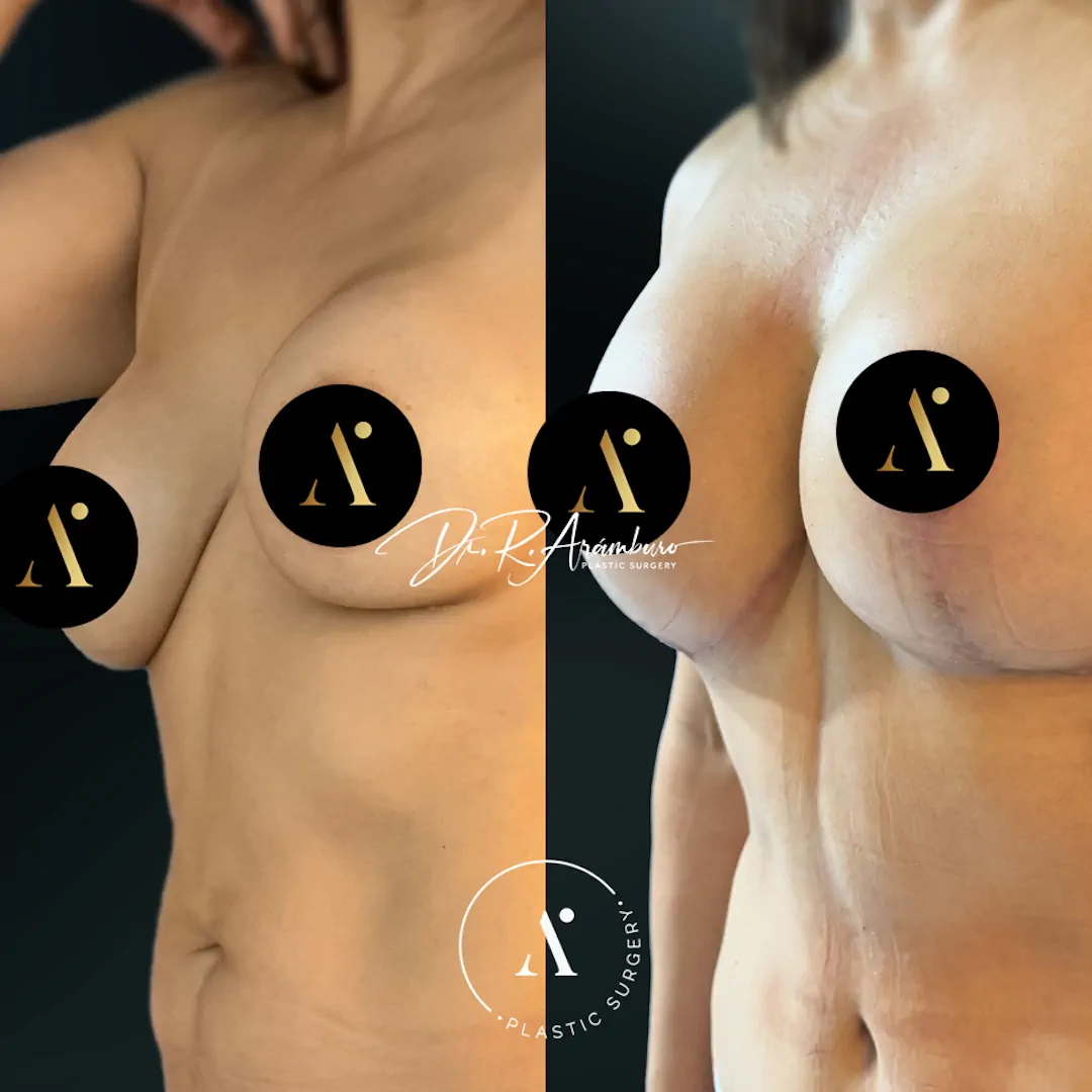 MASTOCONIMPL(1)