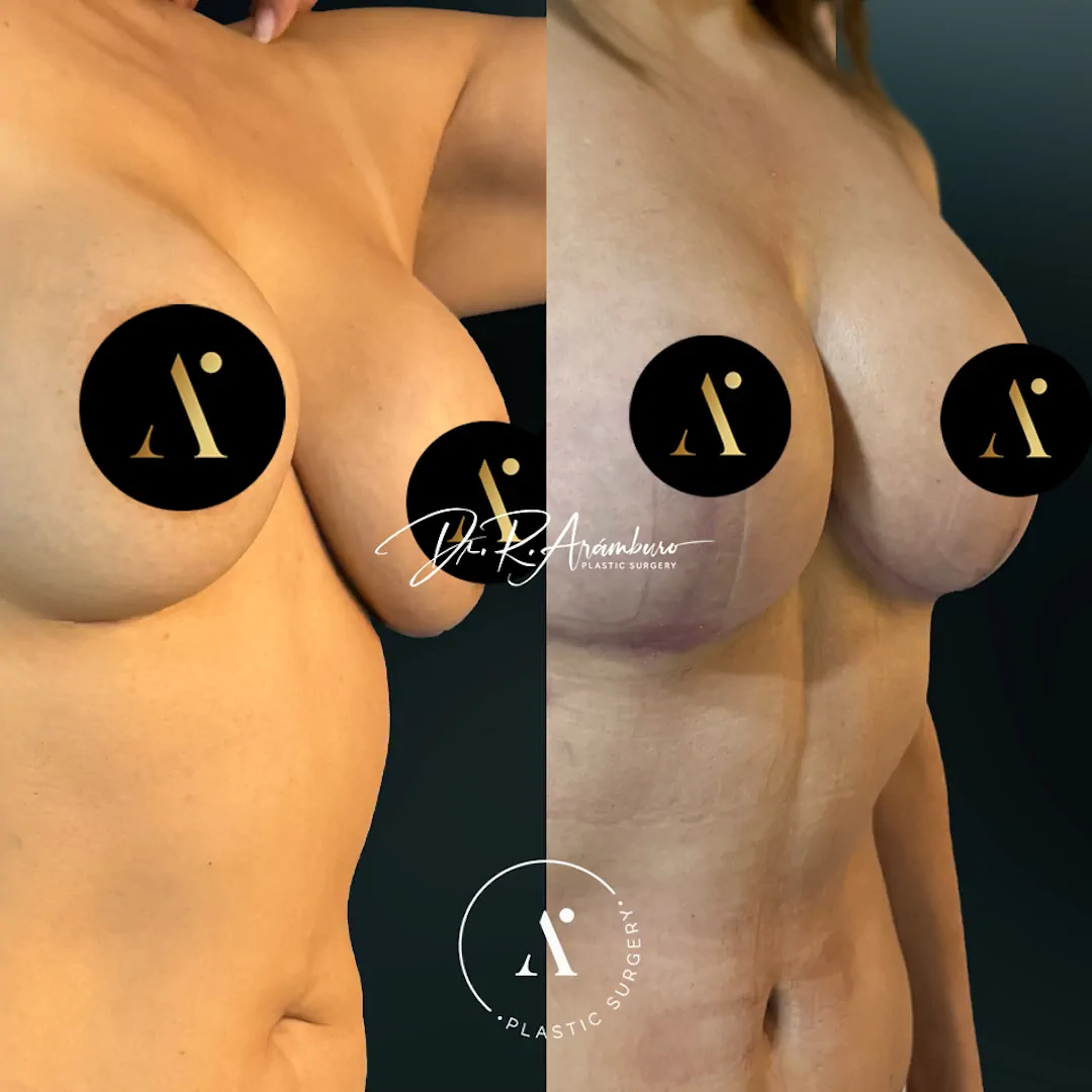 MASTOCONIMPL(2)