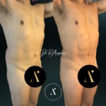 SPARTAN(5)