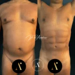 SPARTANBODY