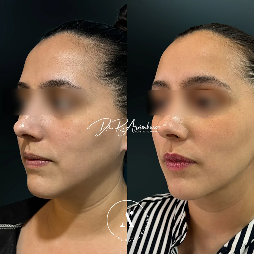 lipopapada(2)