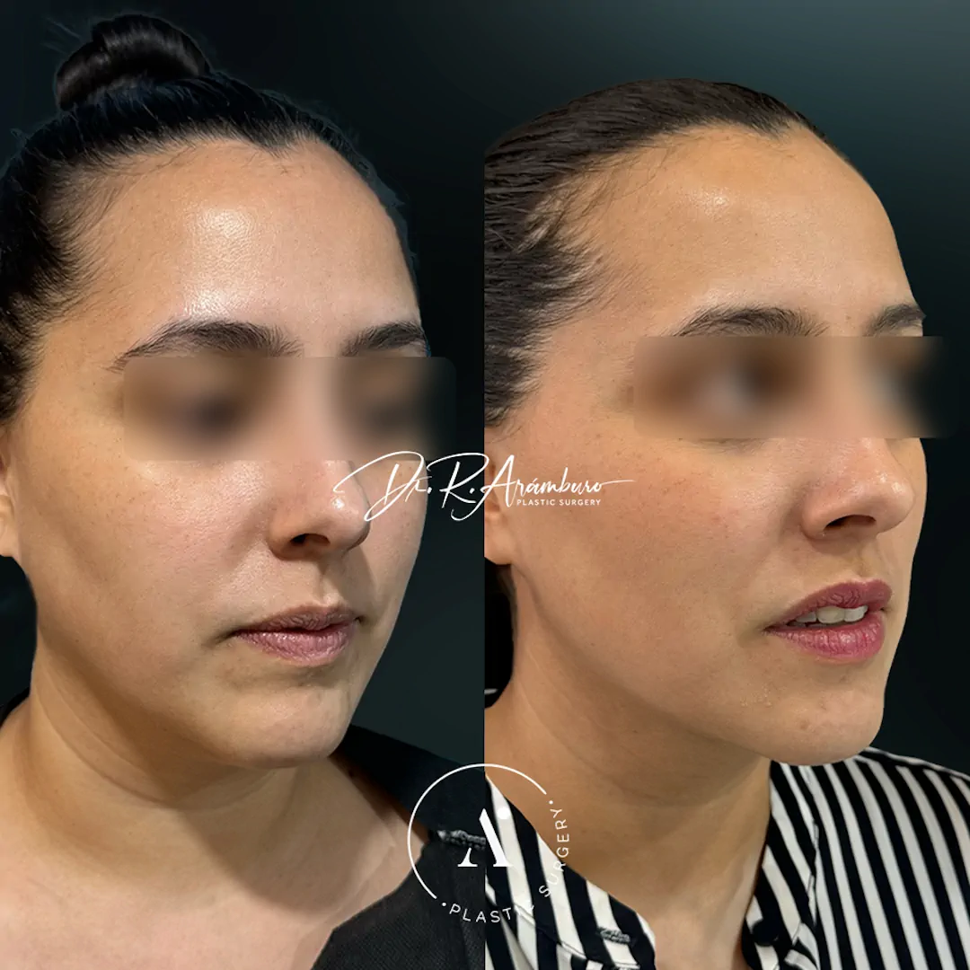 lipopapada(3)