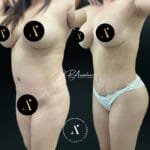 ABDSEC(3)