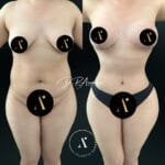 MOMMY MAKEOVER(1)