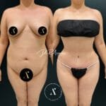 MOMMYMAKEOVER