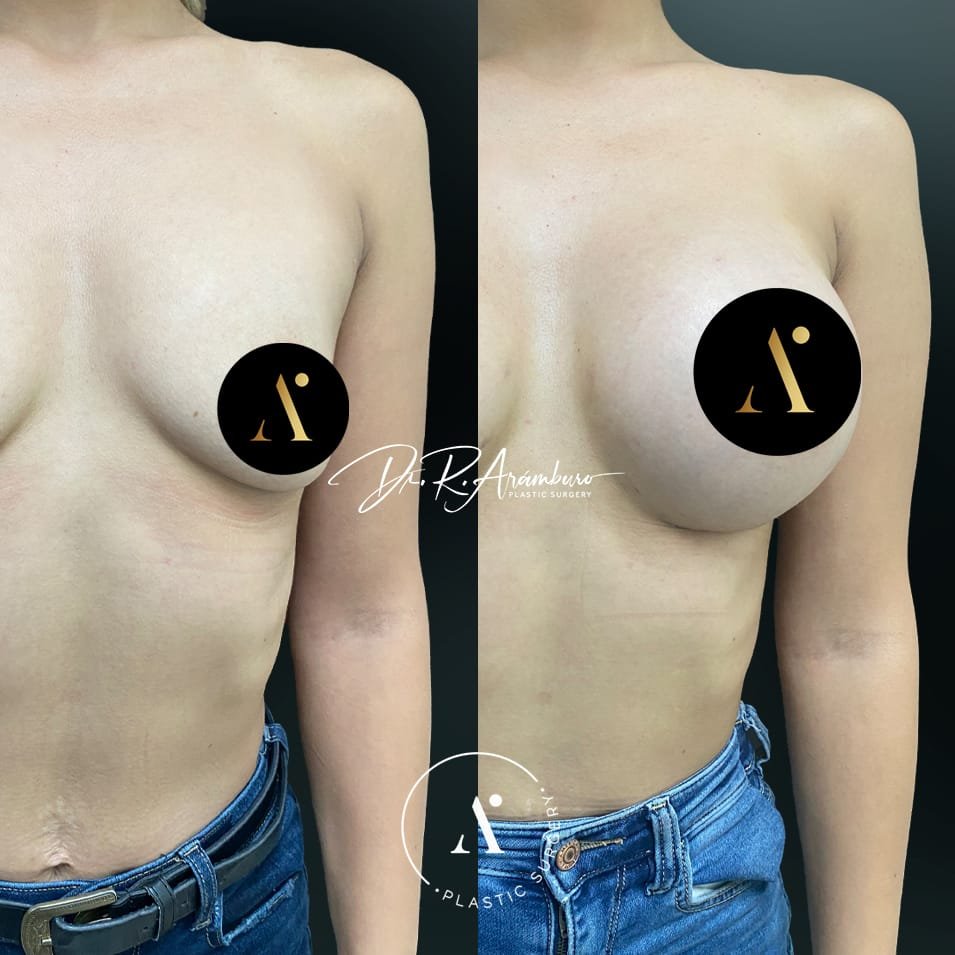 post4 copia