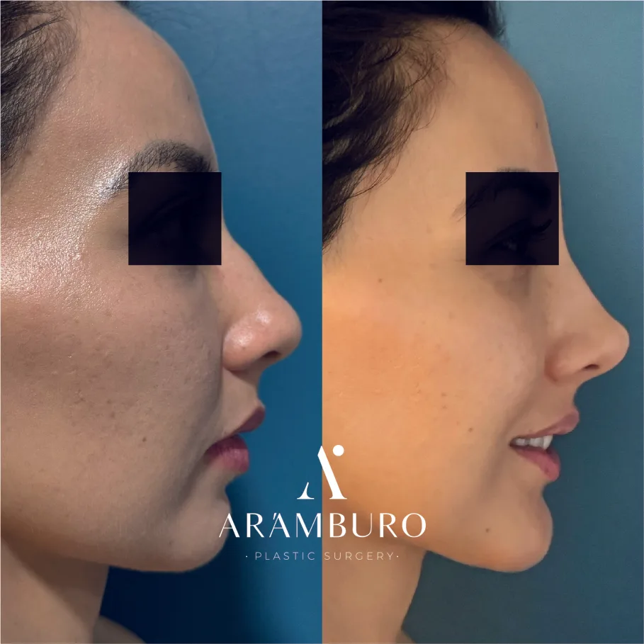 ~ai-c29decc9-c8f1-4a96-b32b-67ae5d310e86_