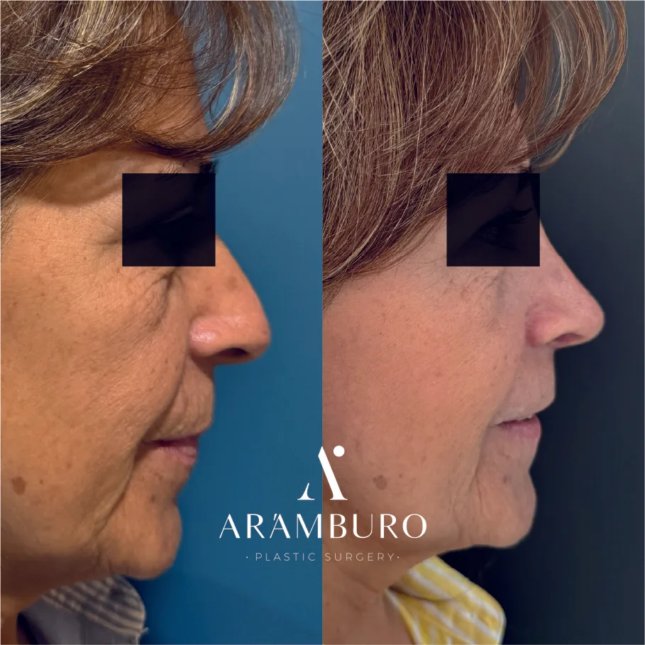 ~ai-c29decc9-c8f1-4a96-b32b-67ae5d310e86_